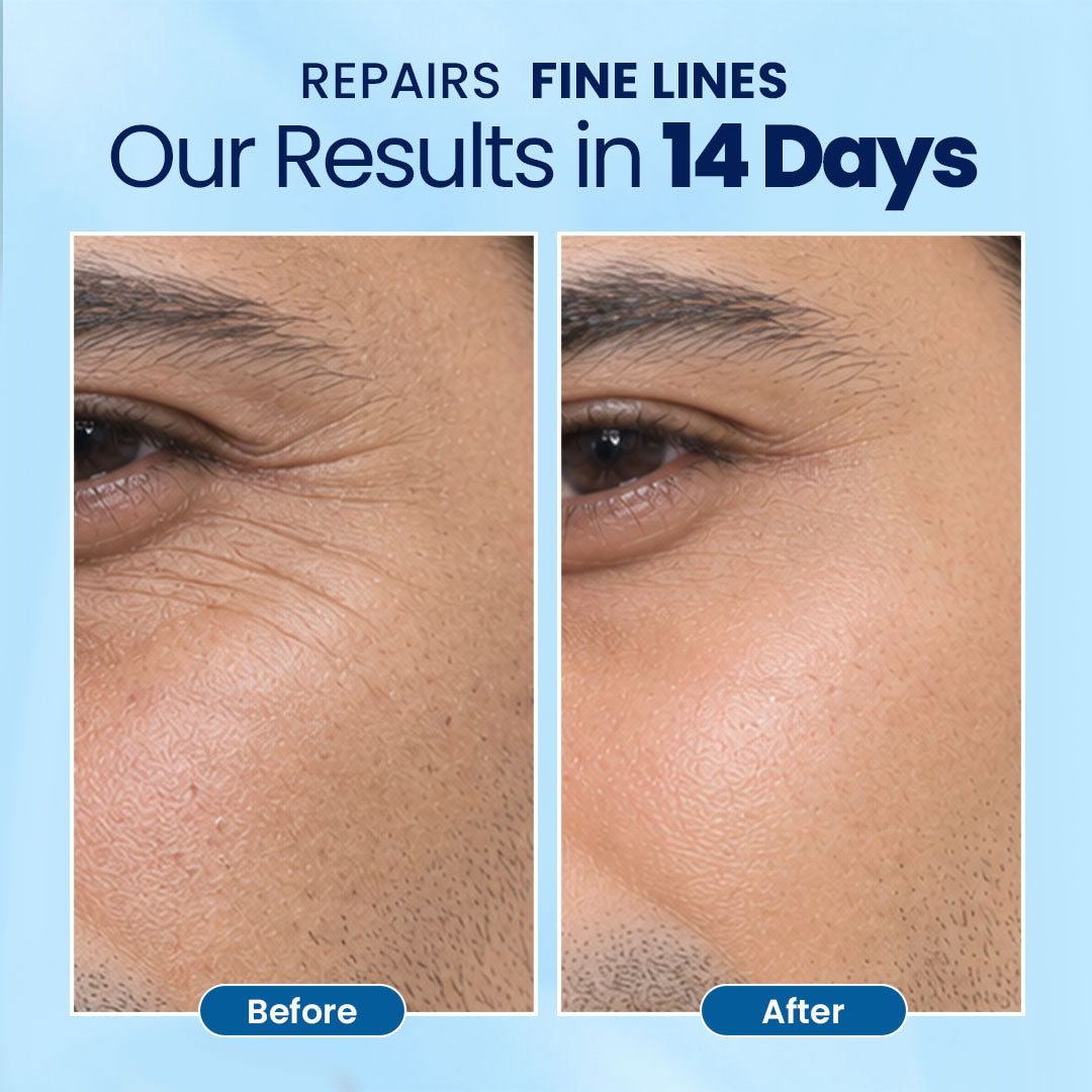 RadianceMax 24H Face Moisturizer Cream- 50 ml | For Normal To Dry Skin