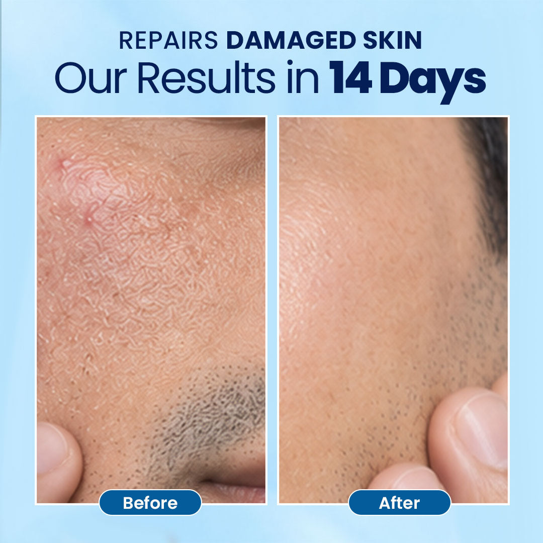 RadianceMax 24H Face Moisturizer Cream- 50 ml | For Normal To Dry Skin