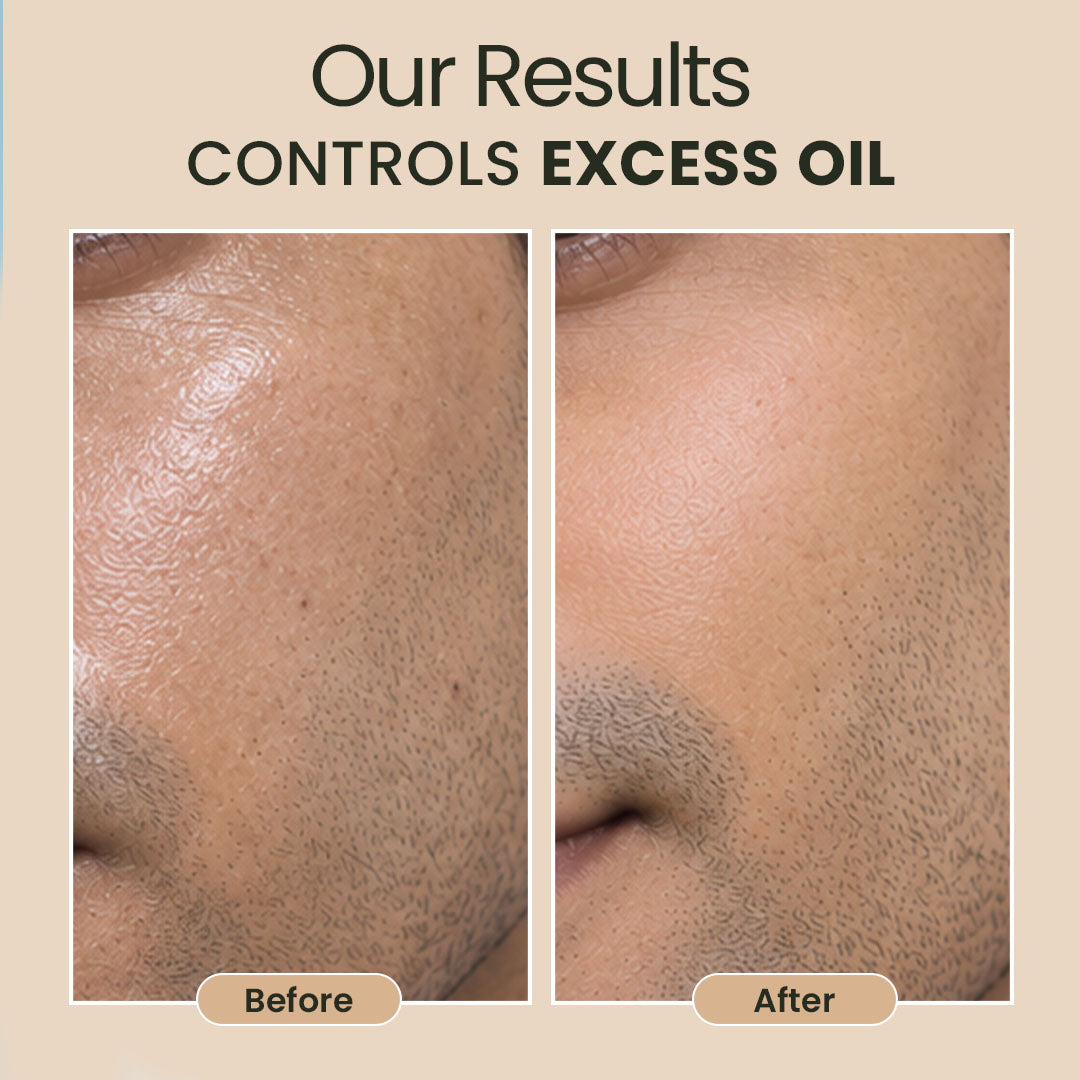 Tinted Sunscreen Moisturizer for Men-30ml | For All Skin Type