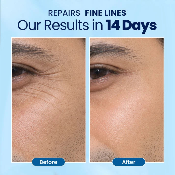 If you have dry skin, RadianceMax is a must-have! 