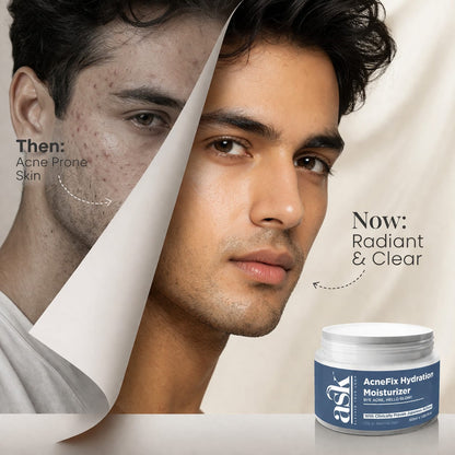 AcneFix Hydration Moisturizer for Men-50 ml | For Oily Skin to Normal Skin